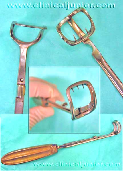 adeniod curette