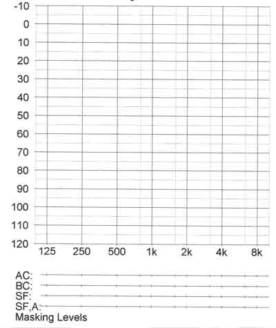 Audiogram Chart Blank